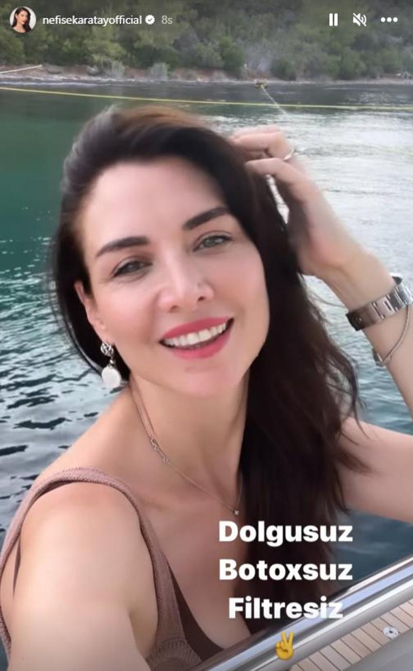 'Botoksum yok' diyen Nefise Karatay'a Demet Akalın'dan bomba yanıt!