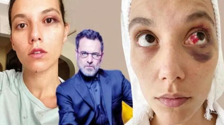 Şiddet iddiasıyla yargılanıyordu!  Ozan Güven için karar verildi 