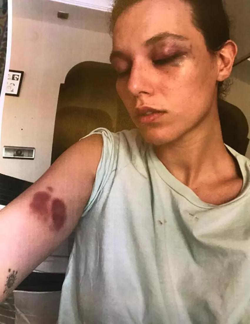 Şiddet iddiasıyla yargılanıyordu!  Ozan Güven için karar verildi 