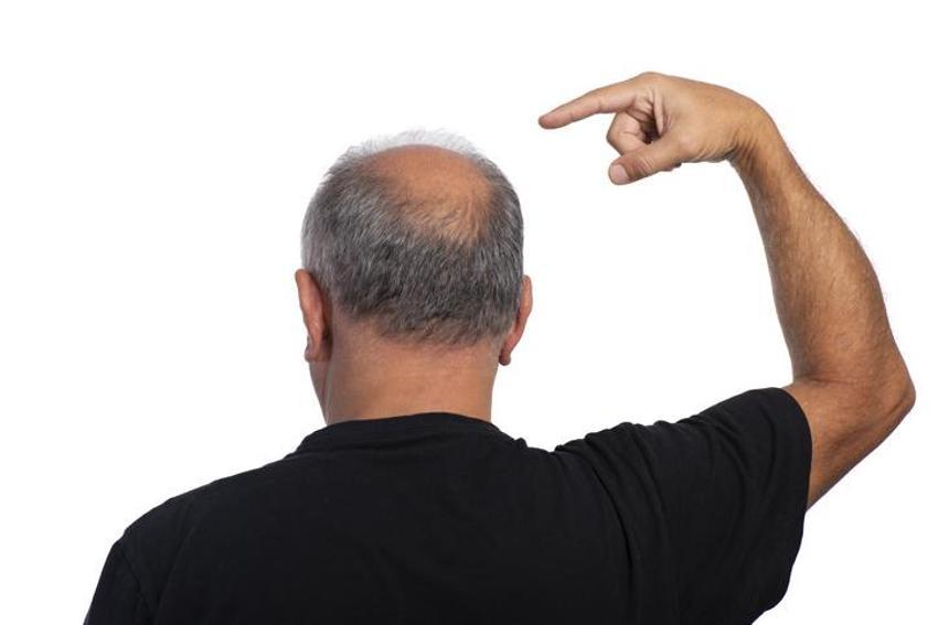 Saç dökülmesini bıçak gibi kesiyor, parlak bir görünüm veriyor! Hepsi A, C, E, B5, B6 ve B12 vitaminleri bakımından çok zengin...  