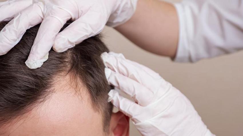 Saç dökülmesini bıçak gibi kesiyor, parlak bir görünüm veriyor! Hepsi A, C, E, B5, B6 ve B12 vitaminleri bakımından çok zengin...  