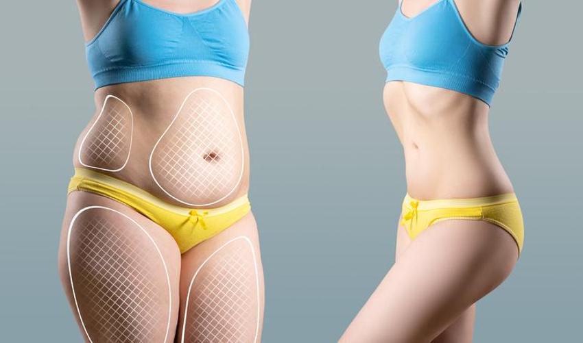 Zayıflama ilacı tehlike saçıyor! Mide felci ve kansere neden oluyor