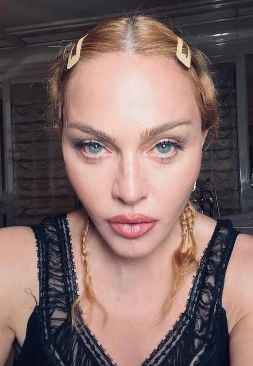 Madonna'dan teşekkür mesajı: Hayatta olduğum için şanslı hissediyorum