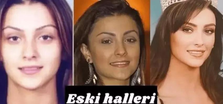 Özge Ulusoy'u tiye alan Yeliz Yeşilmen'e cevap: Sana benzeyip 2+1 ev gibi mi olsun?