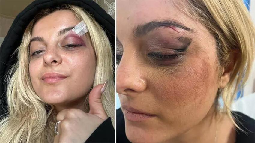 Ünlü şarkıcı fazla kiloları sebebiyle terk edildi!