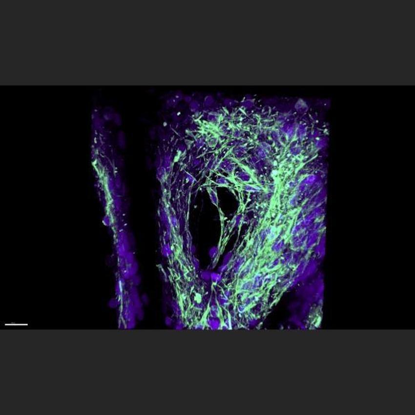 Parkinson ve Alzheimer hastalarını umutlandıran gelişme!
