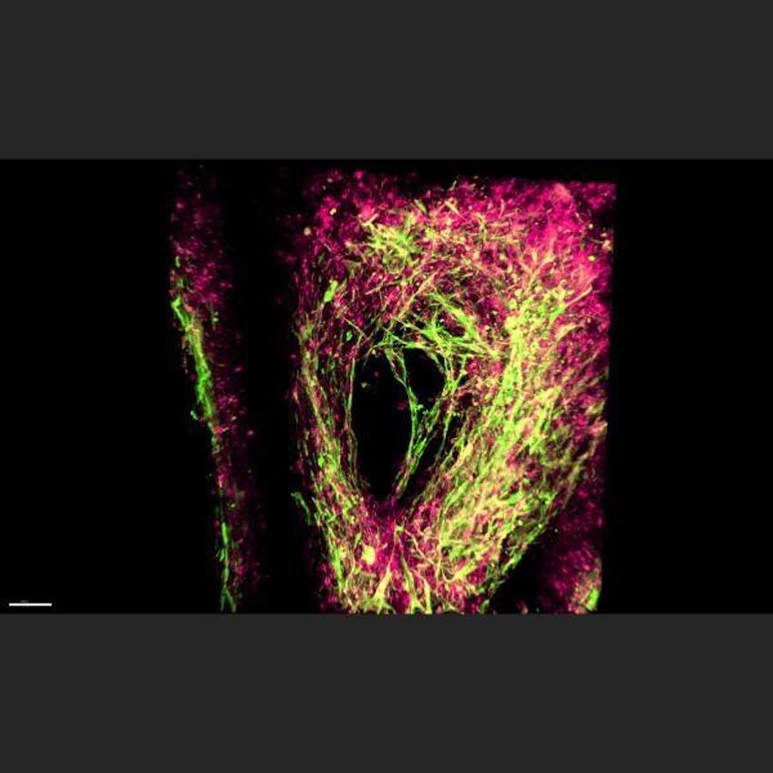 Parkinson ve Alzheimer hastalarını umutlandıran gelişme!