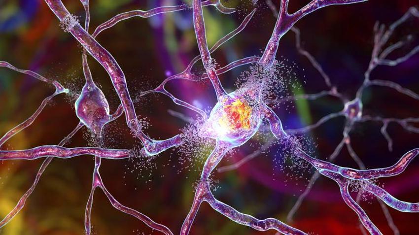 Parkinson ve Alzheimer hastalarını umutlandıran gelişme!
