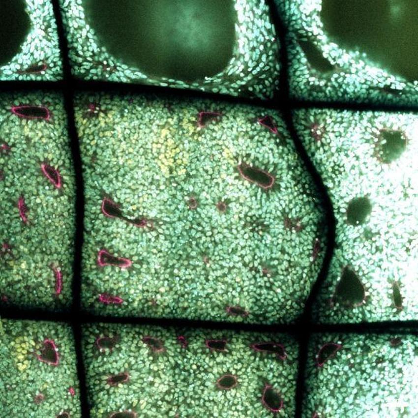 Parkinson ve Alzheimer hastalarını umutlandıran gelişme!