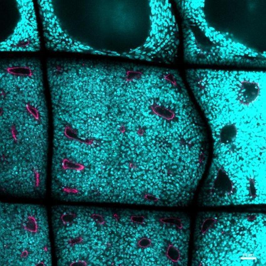 Parkinson ve Alzheimer hastalarını umutlandıran gelişme!