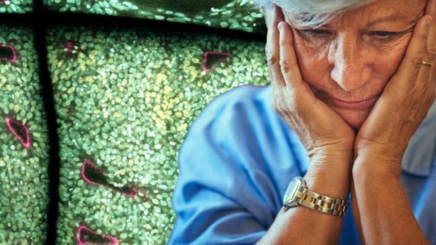 Parkinson ve Alzheimer hastalarını umutlandıran gelişme!