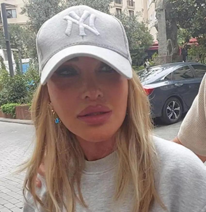 Dumping Sendromuyla mücadele ediyordu! Seren Serengil: Her yemekten sonra fenalaşıyorum!