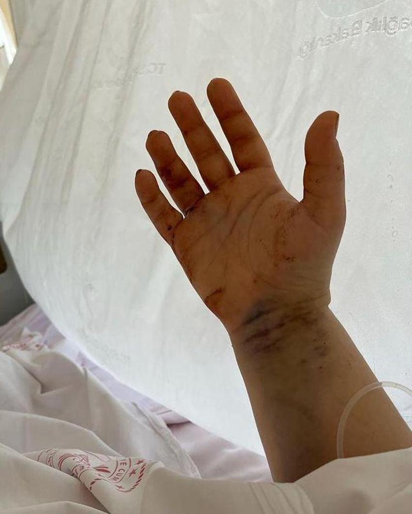 Eşi tarafından 32 yerinden bıçaklanan YouTuber Merve Veziroğlu’ndan ilk paylaşım geldi!