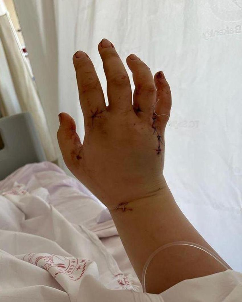 Eşi tarafından 32 yerinden bıçaklanan YouTuber Merve Veziroğlu’ndan ilk paylaşım geldi!