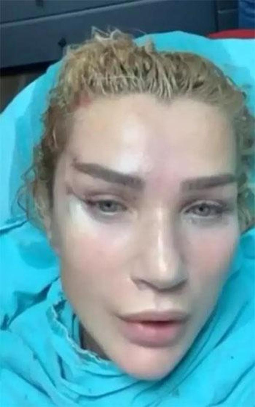Seda Sayan yine estetik yaptırdı: 'Dekolte Canavarı' için doktorun kapısını çaldı