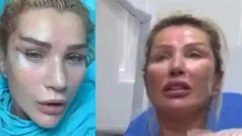 Seda Sayan yine estetik yaptırdı: 'Dekolte Canavarı' için doktorun kapısını çaldı