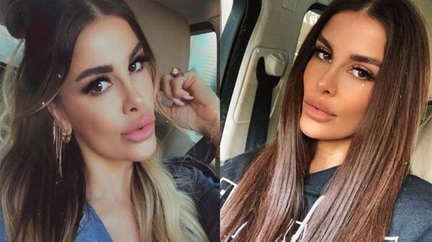 Oyuncu Tuğçe Özbudak kısmi felç geçirdi! Ameliyat öncesi dua istedi