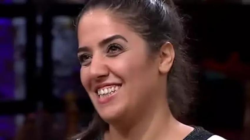 MasterChef Azize'nin ilk halini gören unutamıyor! MasterChef Azize hangi estetikleri yaptırdı?