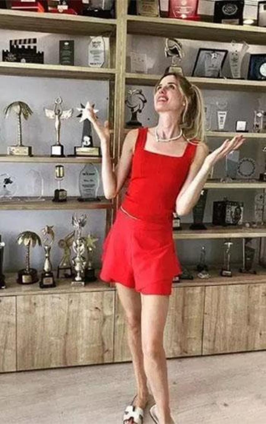 Doğumuna günler kaldı: Wilma Elles karnı burnunda podyuma çıktı