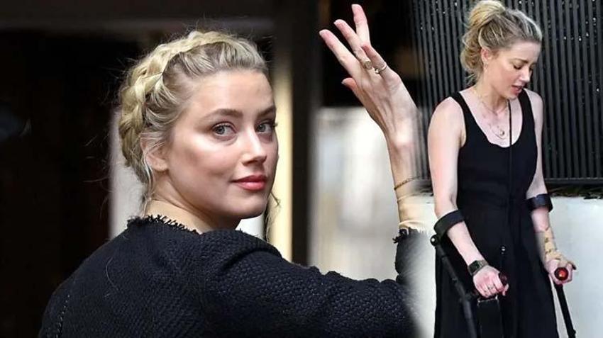 Amber Heard olaylı davayı kaybettikten sonra koltuk değnekleriyle görüntülendi!