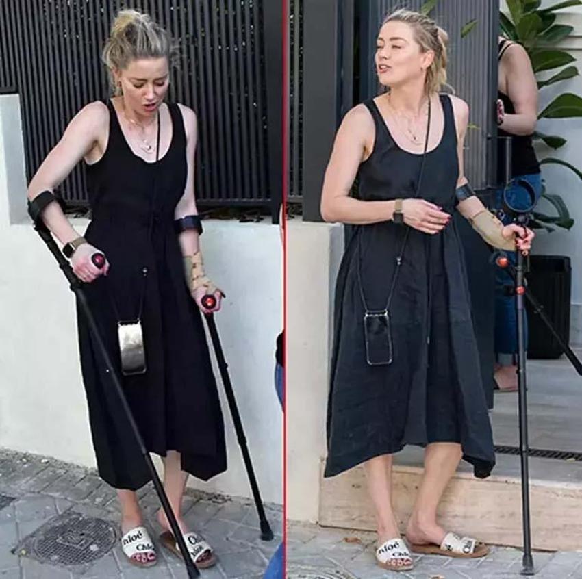 Amber Heard olaylı davayı kaybettikten sonra koltuk değnekleriyle görüntülendi!