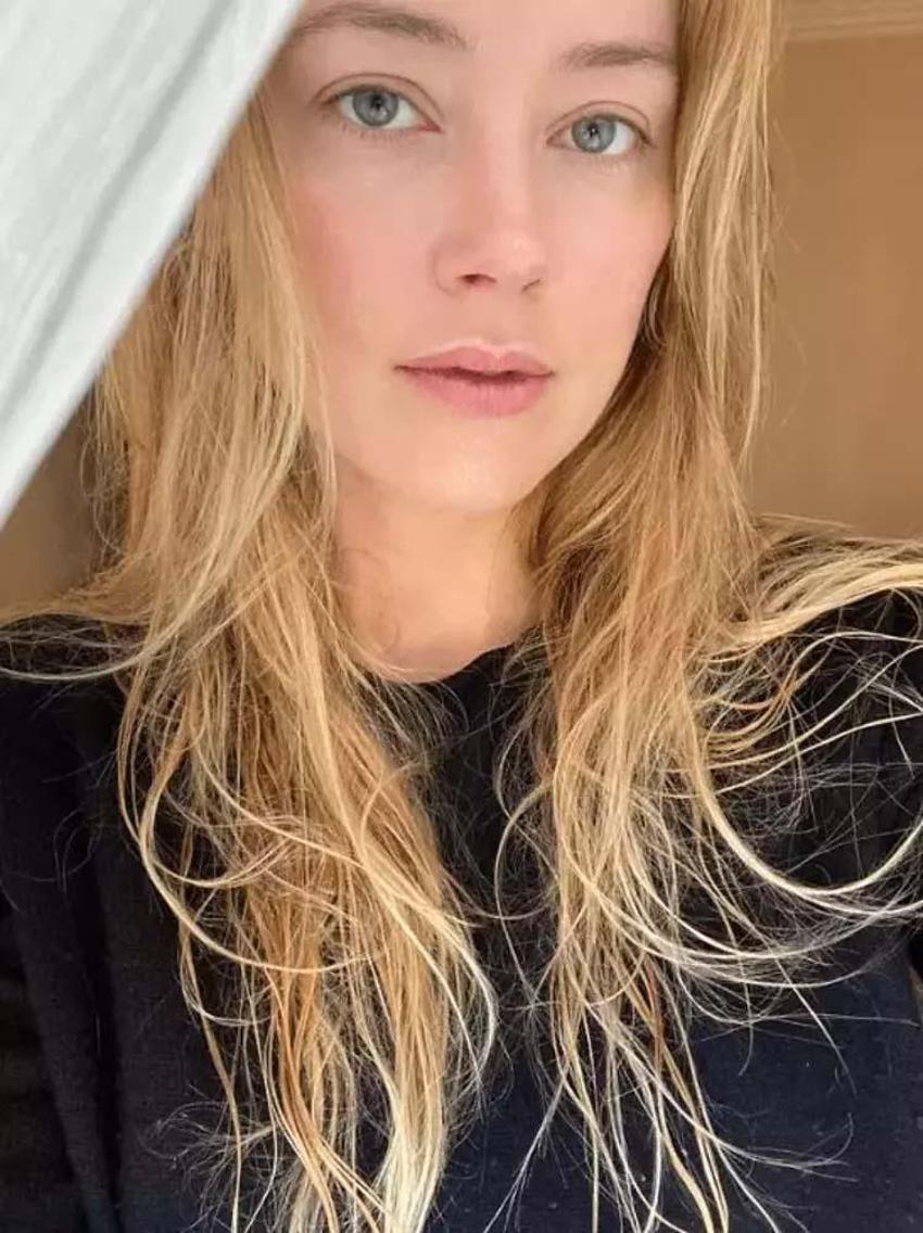 Amber Heard olaylı davayı kaybettikten sonra koltuk değnekleriyle görüntülendi!