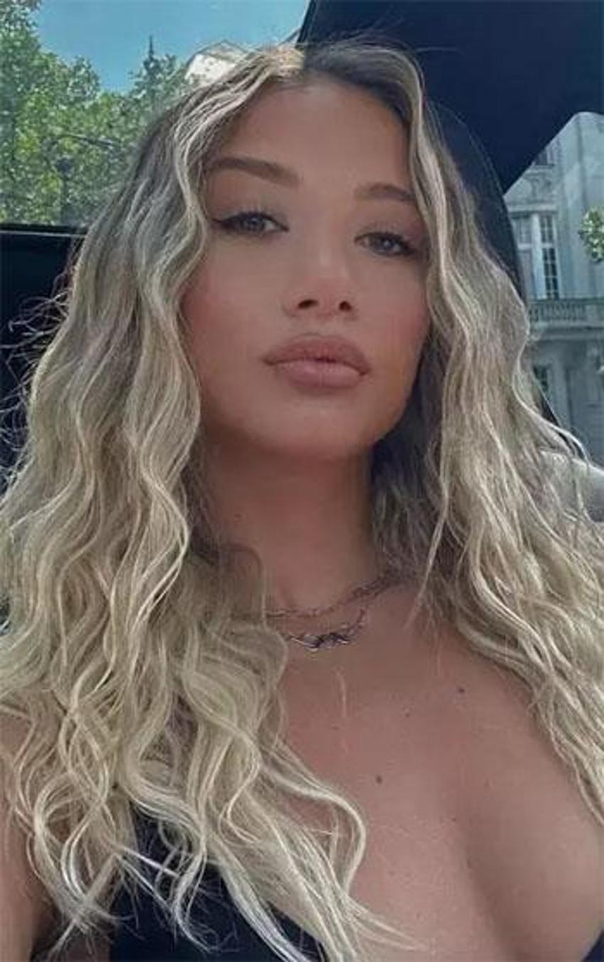 Aleyna Kalaycıoğlu'ndan Berkay'a sert sözler: 'Onun yüzünden çok ağzım yandı'