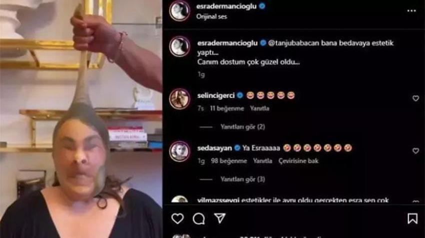 Esra Dermancıoğlu estetik yaptıranları ti'ye aldı: Yüzüne çorap geçirdi