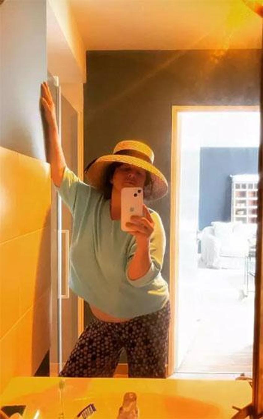 Esra Dermancıoğlu estetik yaptıranları ti'ye aldı: Yüzüne çorap geçirdi