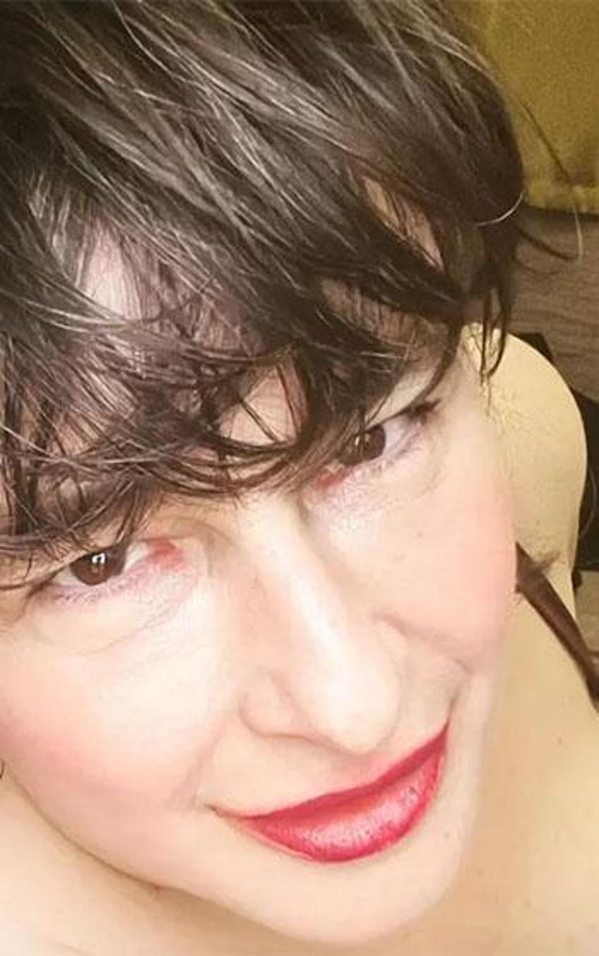 Esra Dermancıoğlu estetik yaptıranları ti'ye aldı: Yüzüne çorap geçirdi