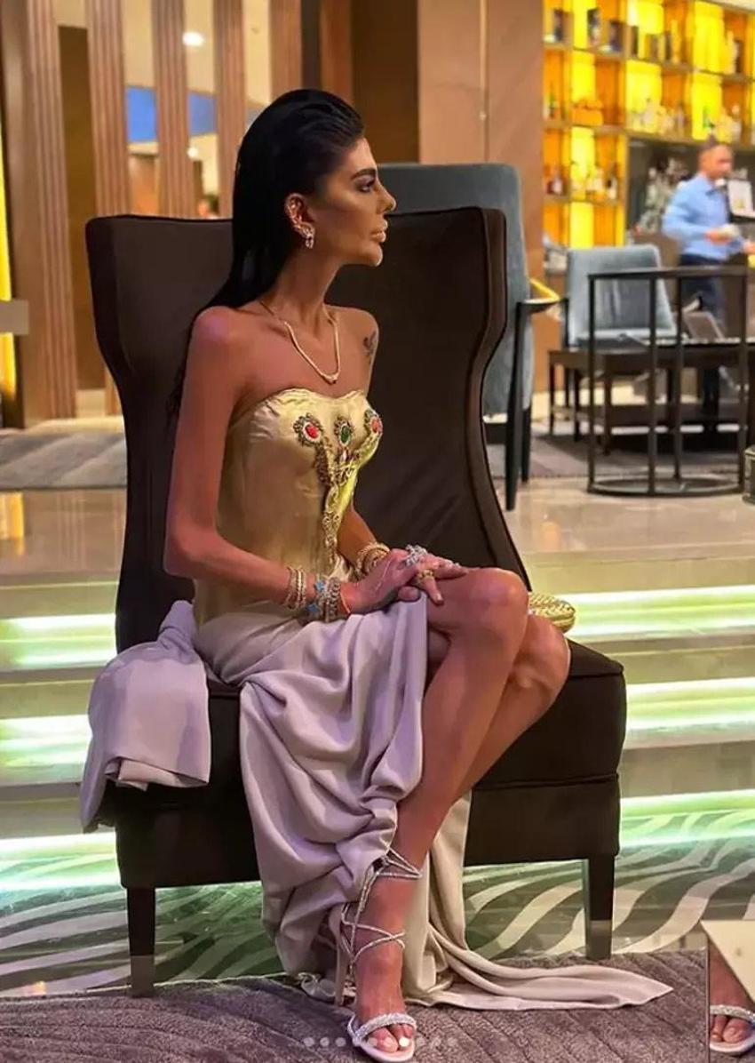 Süreyya Yalçın altın kaplamalı elbise giydi! Zayıflığı ile çok konuşulmuştu şimdi de kıyafetinin fiyatı gündem oldu 