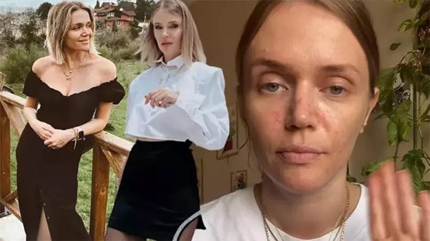 Ecem Karavus: Artık suratım şiddetle mücadele edemiyor, 50 gündür sürüyor