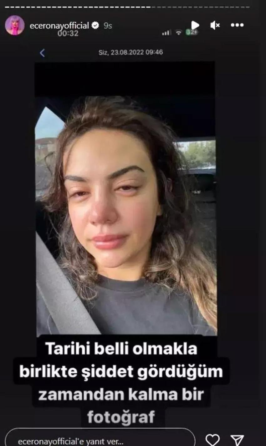 Ece Ronay'dan 'şiddet' açıklaması! 'Psikolojik olarak tükendim'