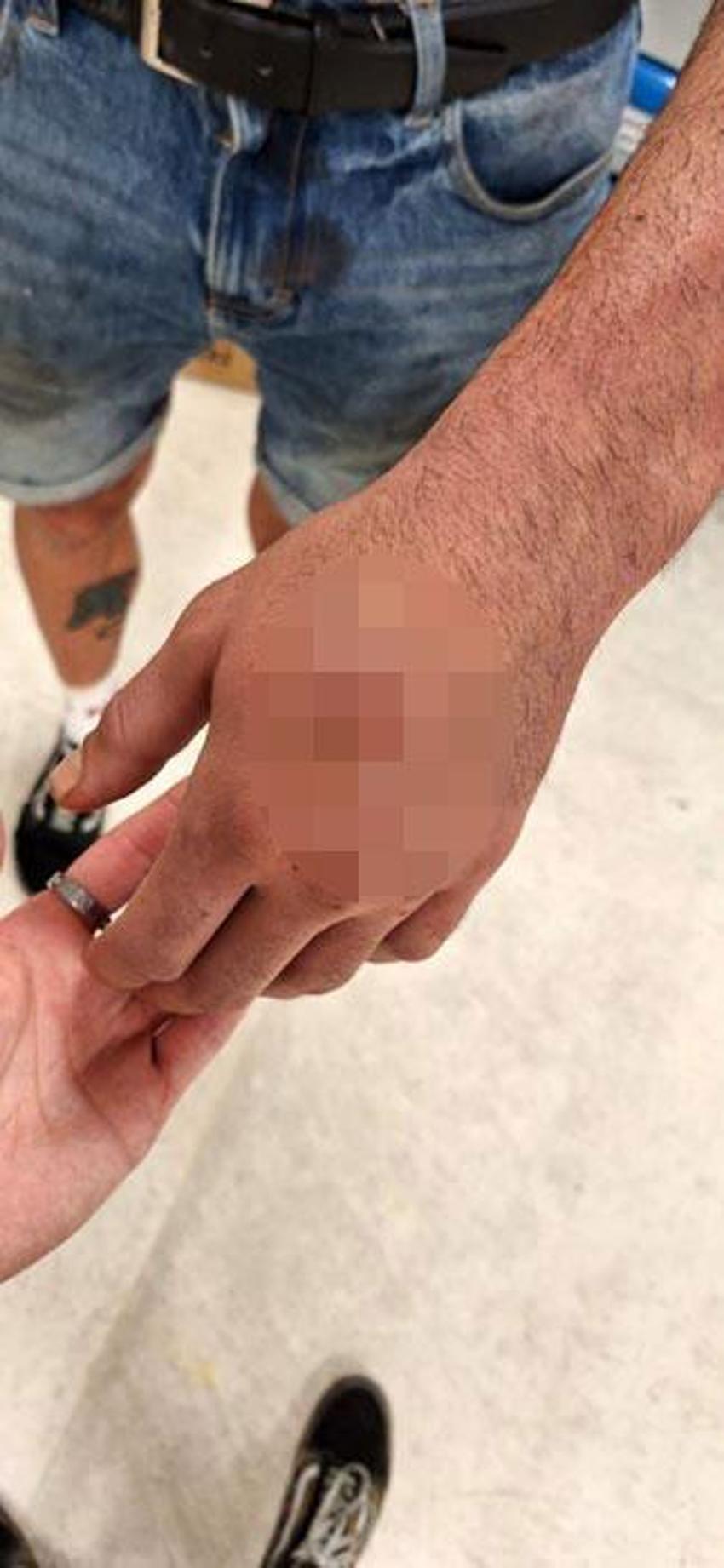 Taksim’de genç çifte çivili sopalı saldırı! Öldüresiye dövdüler