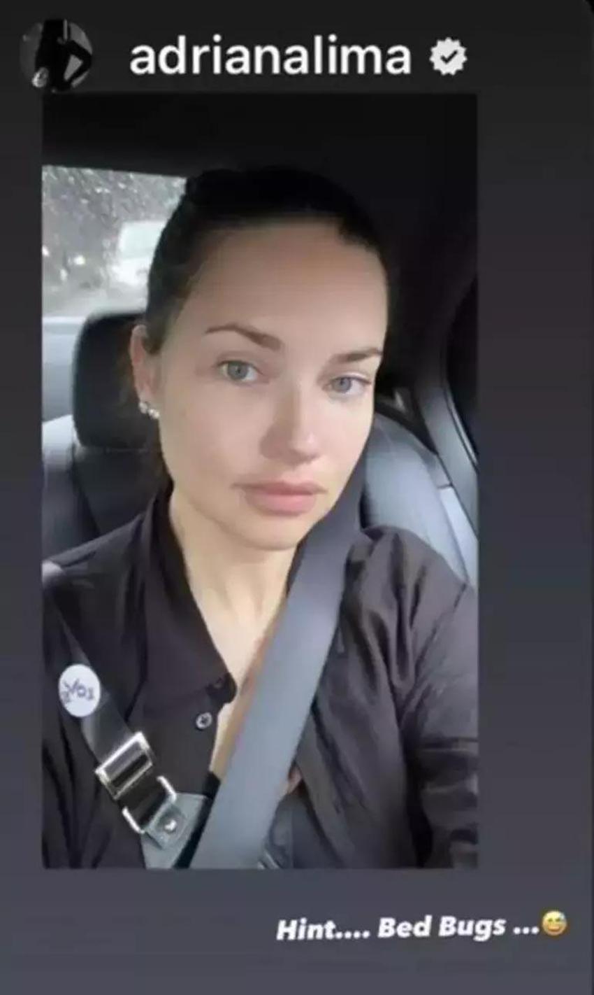 Adriana Lima, Fransa’da tahtakurusu istilasına uğradı! Lüks otelde şoku yaşadı!