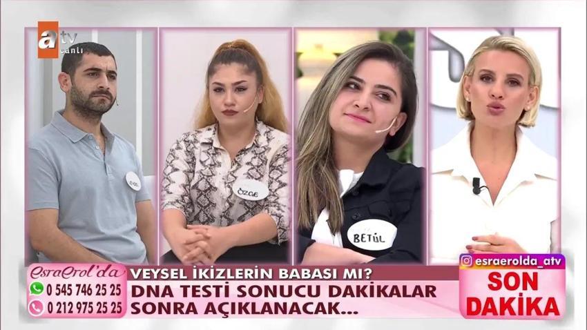 İkiz bebeklerin babaları farklı olabilir mi (babaları farklı nasıl olur)? Heteropaternal Süperfekondasyo nedir? İkiz bebeklerden birinin babası farklı
