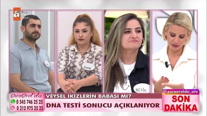 İkiz bebeklerin babaları farklı olabilir mi (babaları farklı nasıl olur)? Heteropaternal Süperfekondasyo nedir? İkiz bebeklerden birinin babası farklı