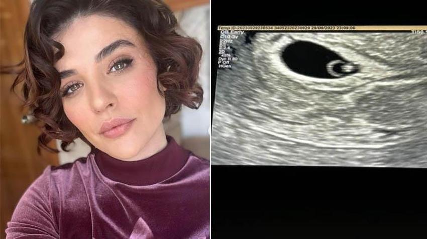 Gonca Vuslateri, bebeğinin ultrason görüntüsünü paylaştı