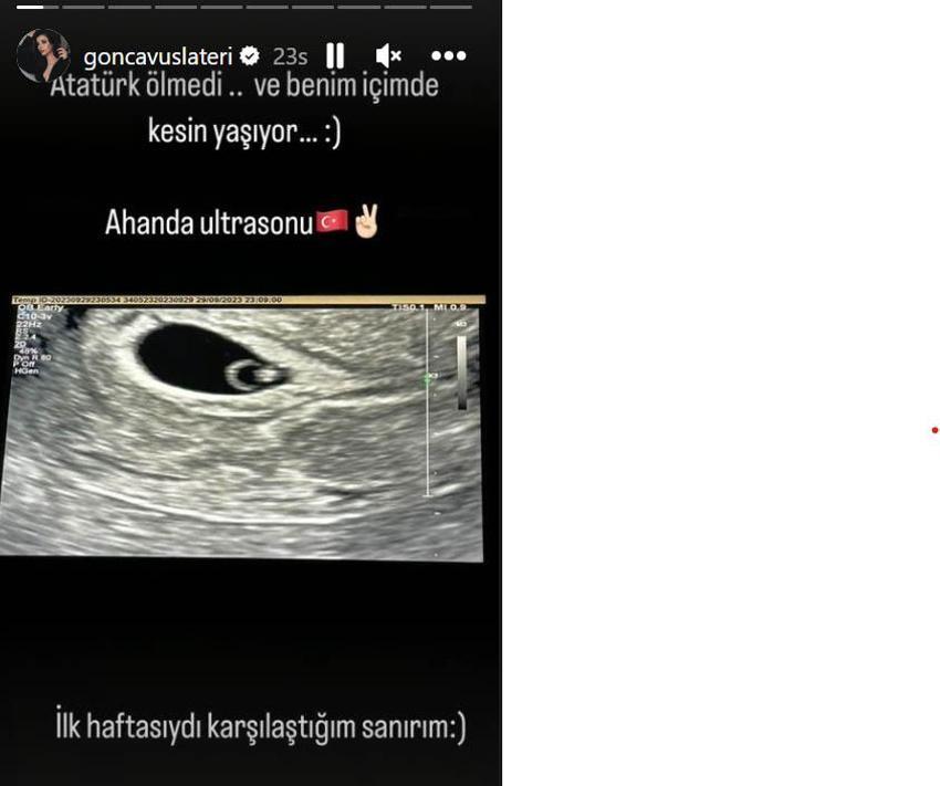 Gonca Vuslateri, bebeğinin ultrason görüntüsünü paylaştı