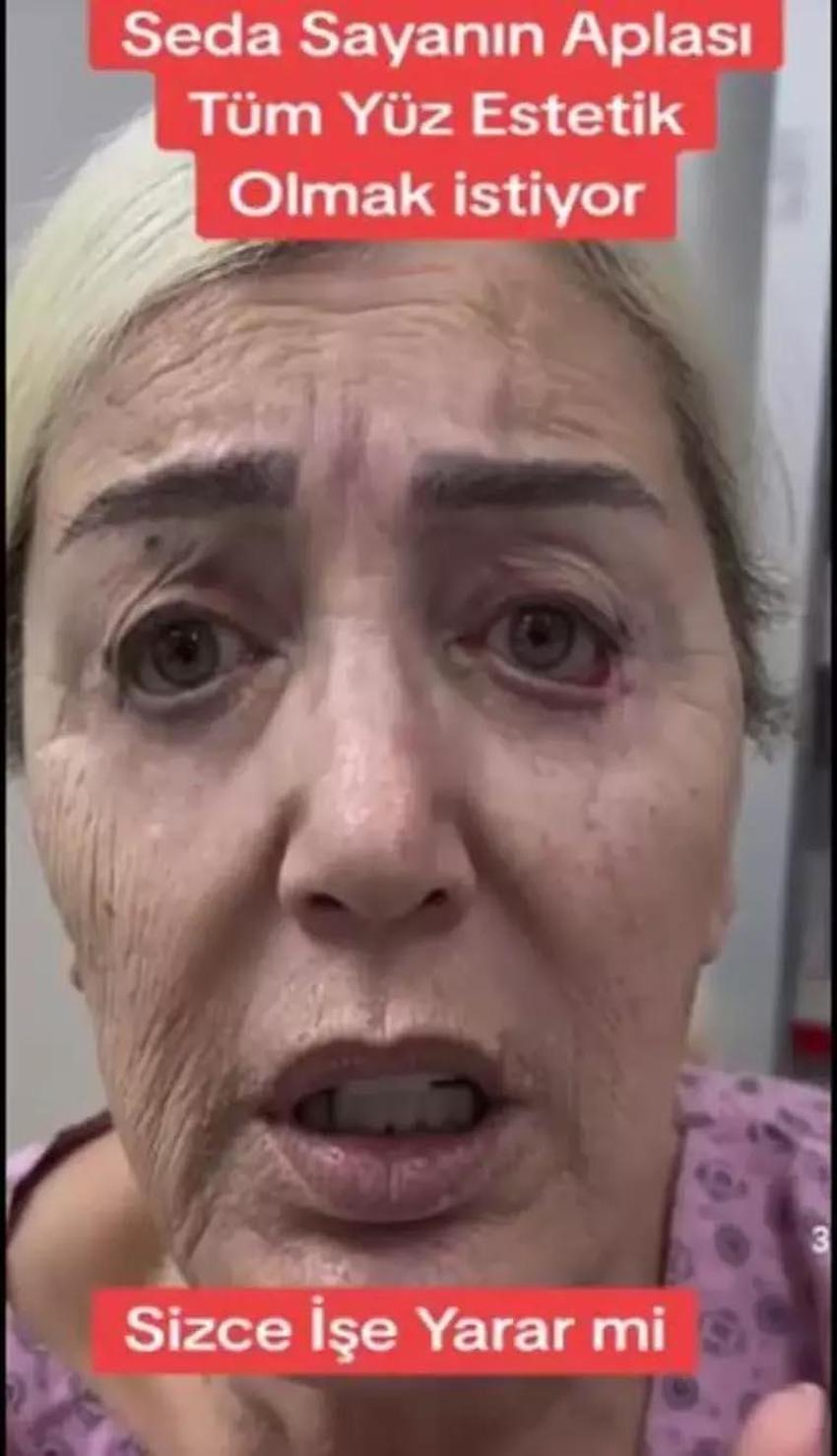 Seda Sayan ablası Nursel Sayan da yüzünü gerdirdi! Değişimi çok konuşuldu
