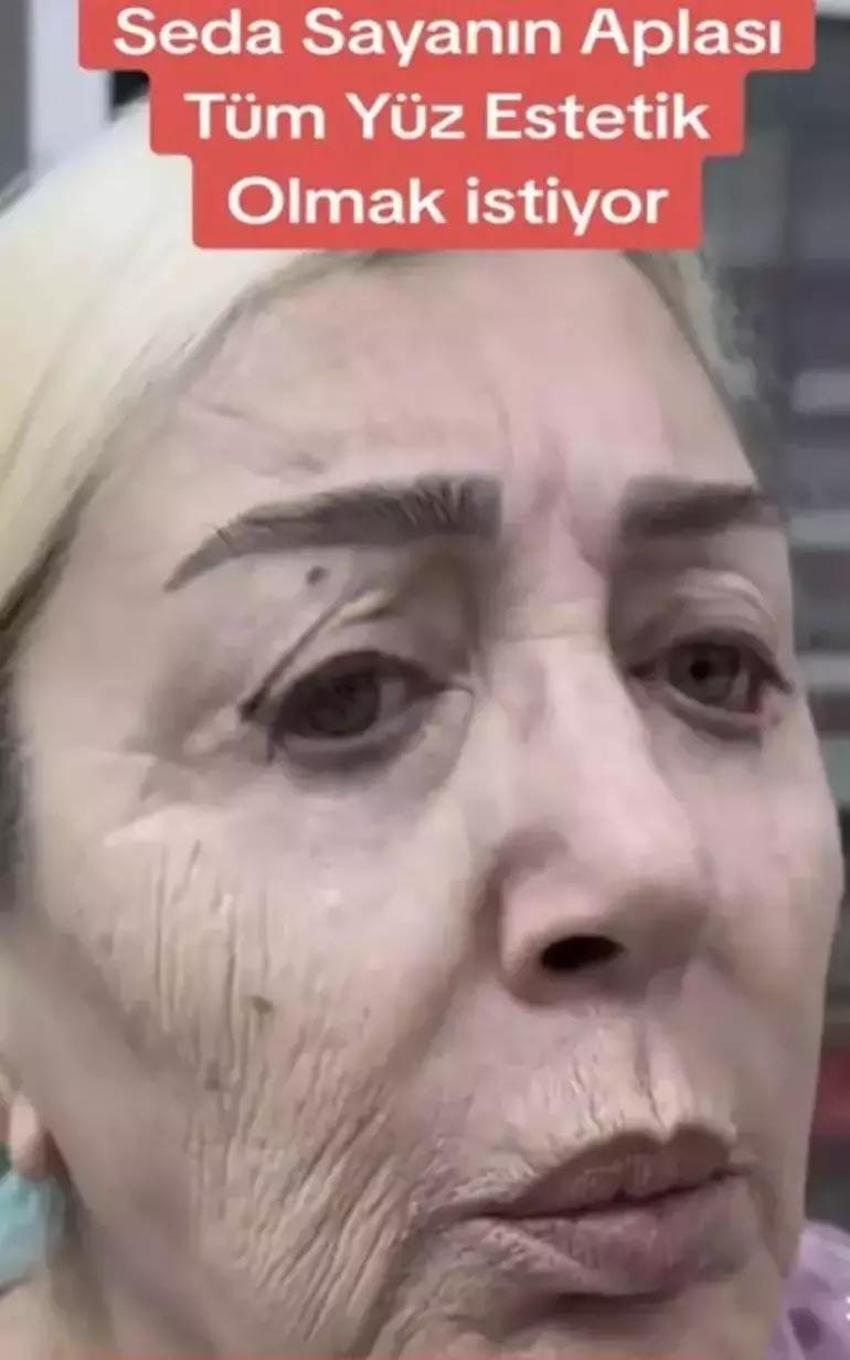 Seda Sayan ablası Nursel Sayan da yüzünü gerdirdi! Değişimi çok konuşuldu