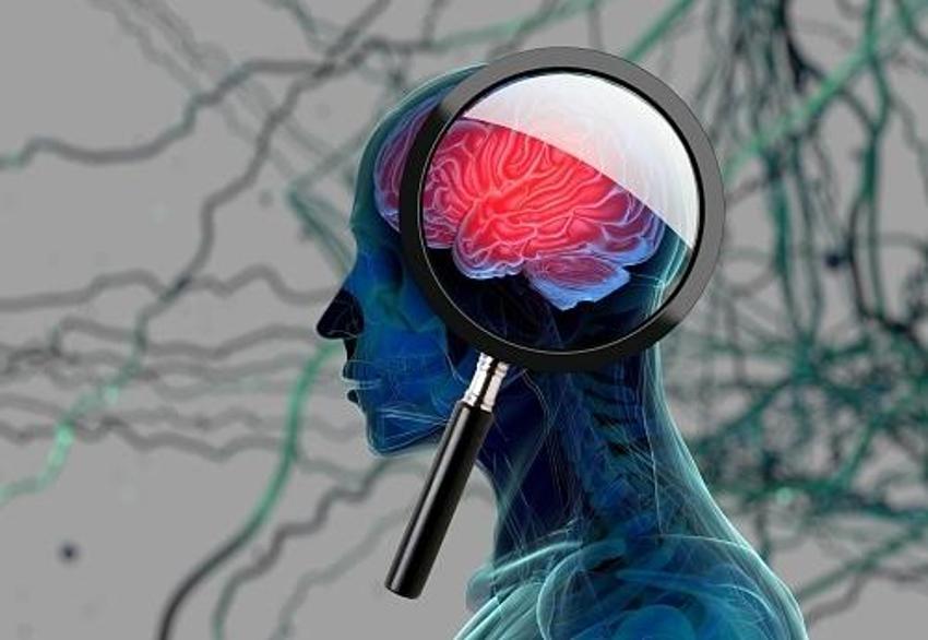 Vücudunuz Alzheimer'ı 15 yıl önceden haber veriyor! Hemen kontrol edin