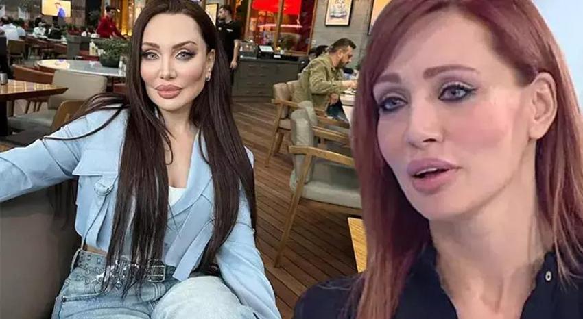 Yerli Angelina Jolie Umut Akyürek son yaptırdığı estetikle şaşırttı
