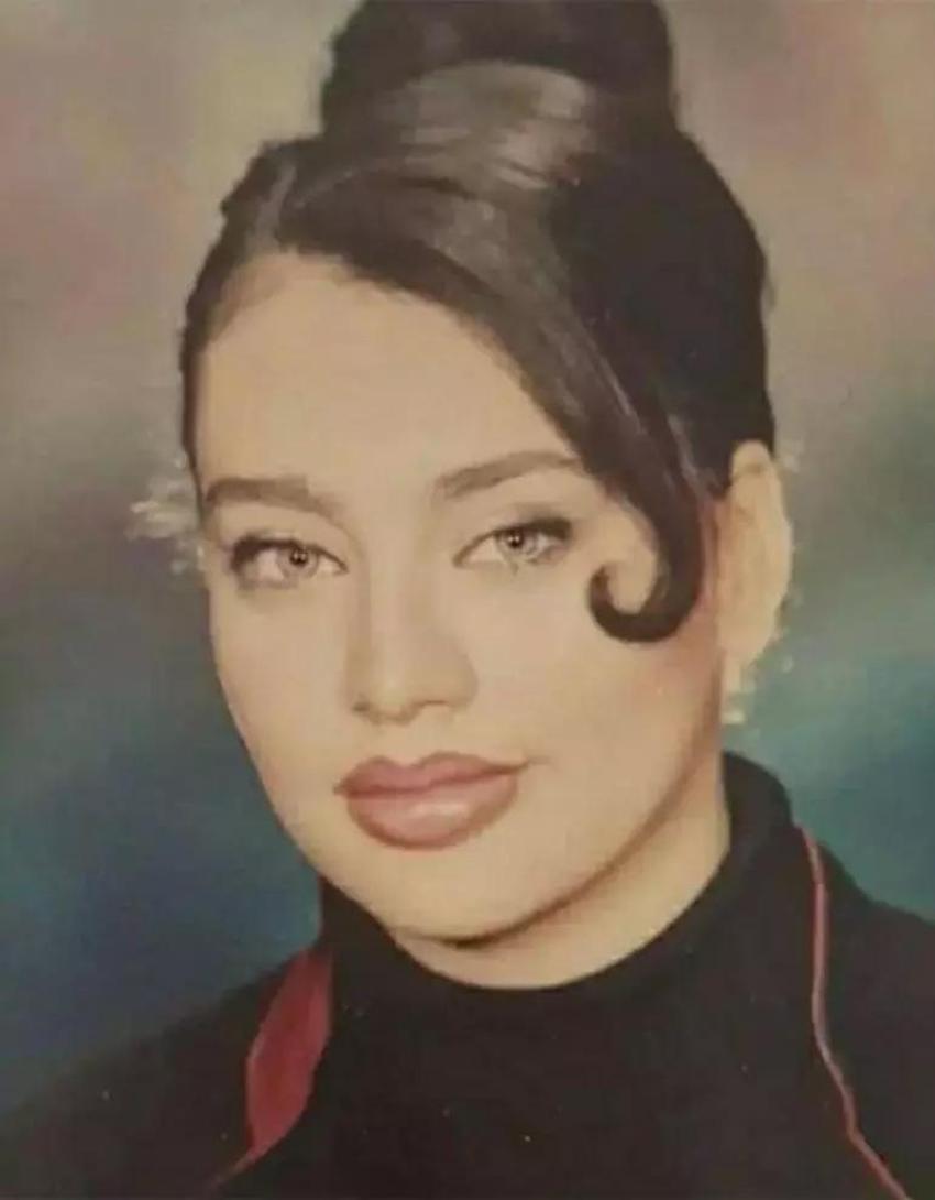 Yerli Angelina Jolie Umut Akyürek son yaptırdığı estetikle şaşırttı