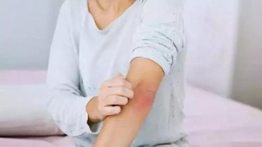 Gece Kaşıntısı Nasıl Geçer? Gece Kaşıntısı Geçiren Yöntemler, Püf Noktaları Nelerdir?