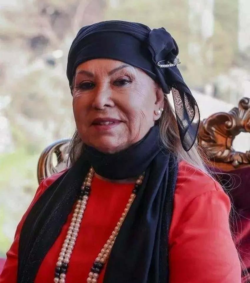 Bedia Akartürk'ü görenler tanıyamadı! Estetik ameliyatına yenisini ekledi