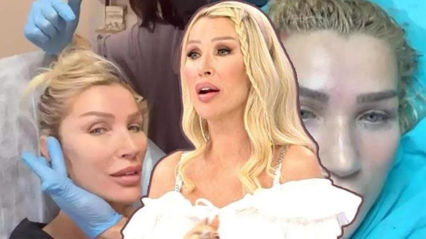 Vücuduna ‘sünnet derisi’ enjekte ettirmişti! Seda Sayan sessizliğini bozdu