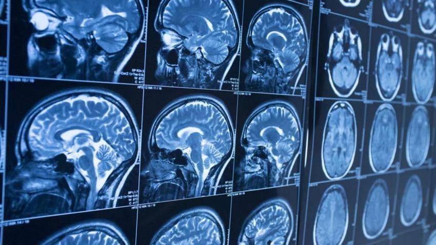 Beyniniz ne durumda: Bu test beyninizin kapasitesini ölçüyor! 