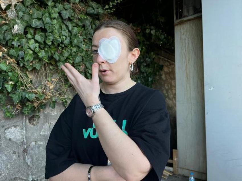 Kafa attı vücudunda sigara söndürdü! Eski sevgili dehşeti kan dondurdu