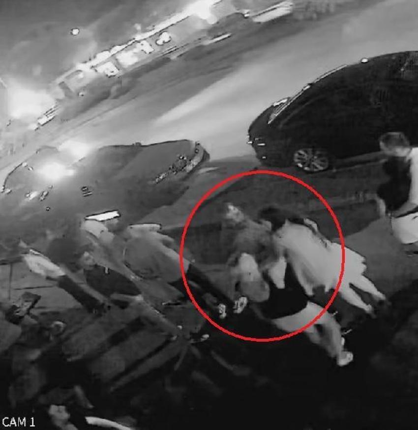 Kafa attı vücudunda sigara söndürdü! Eski sevgili dehşeti kan dondurdu